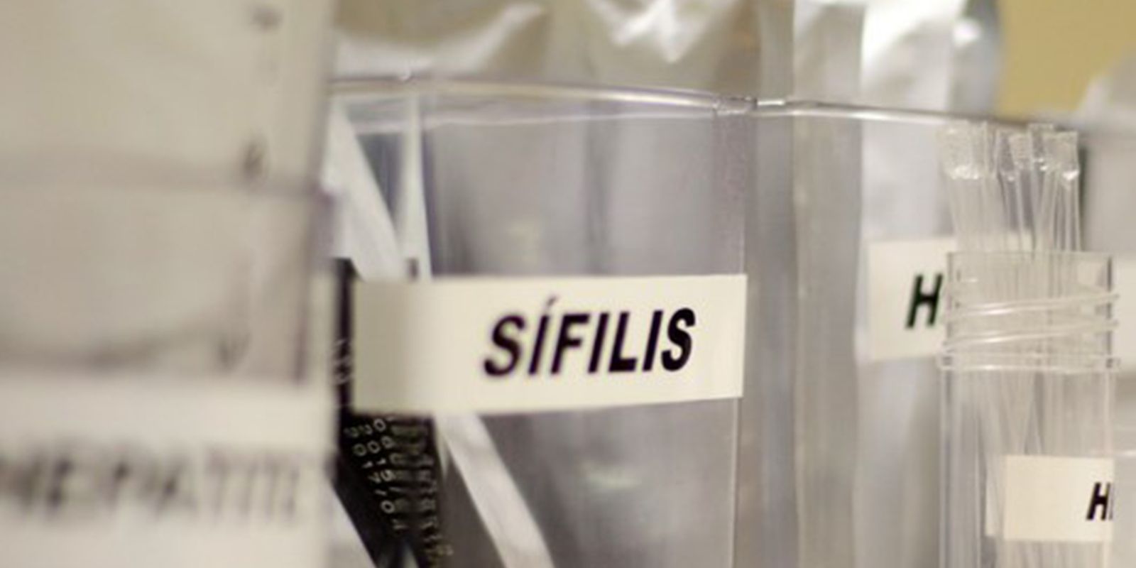 sus-passa-a-adotar-antibiotico-para-prevenir-sifilis-e-clamidia