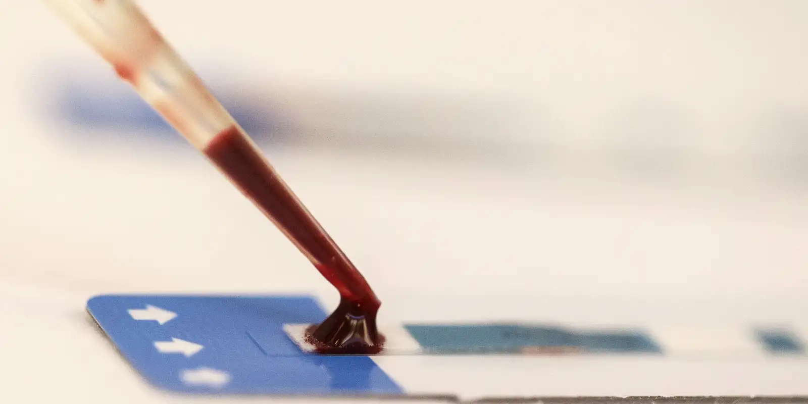 estudo-inedito-da-fiocruz-pode-ampliar-prevencao-de-hiv-entre-jovens